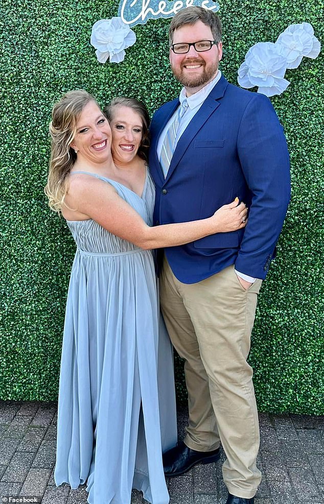 Conjoined twins Abby Hensel (left) and Brittany (center) are one of the few sets of dicephalic twins in history to survive infancy.  They are pictured with Abby's husband, Josh Bowling (right).