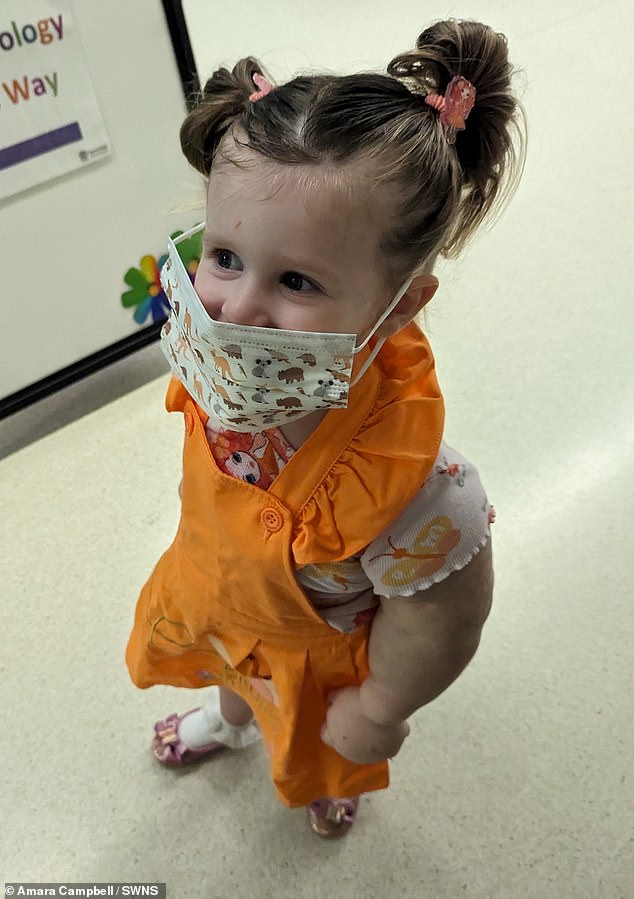 Jessi, now two years old, is still undergoing treatment for her condition which doctors diagnosed as Kippel Trelauney syndrome when she was 11 months old.