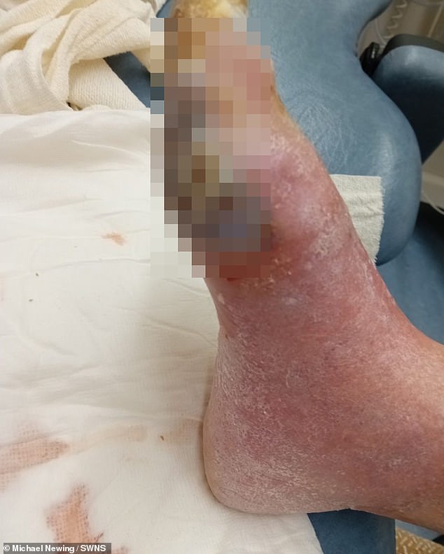 Great-grandmother was told she could die from a septic foot if her leg was not amputated.