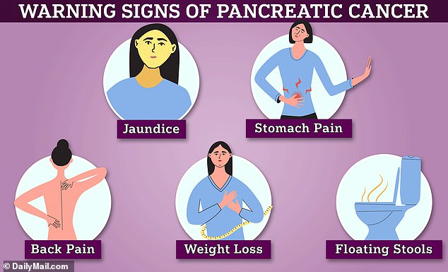 Early signs of pancreatic cancer include jaundice, stomach pain, back pain, weight loss, and floating stools.