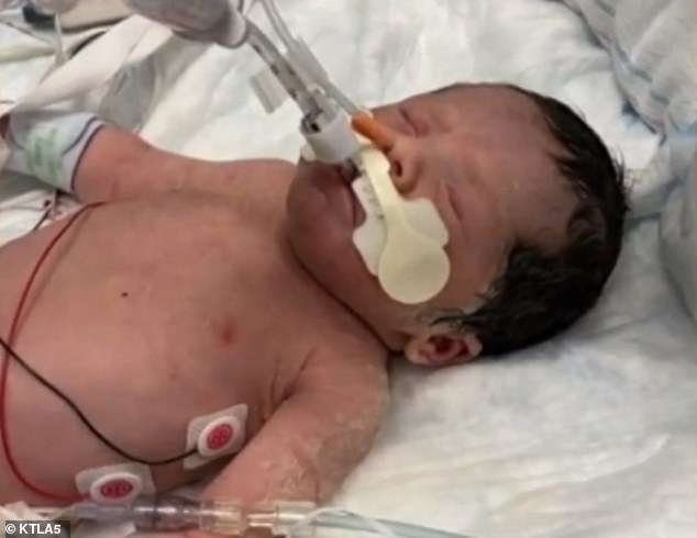 Adalyn Rose was born by emergency cesarean section after the accident. Newborn fights to survive and is being monitored for brain damage at UC Irvine Medical Center