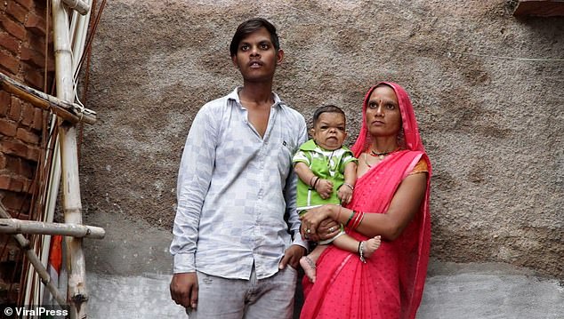 His mother (right), who now carries him on her hip, said they learned he was suffering from 