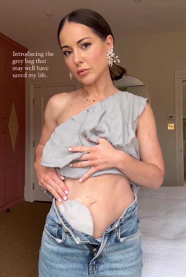 Louise revealed how she was fitted with a stoma bag after years of suffering from ulcerative colitis, and says 