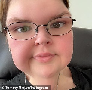 The post comes after Tammy revealed in December that she weighed 285 pounds, down from her starting point of 717; seen in 2024