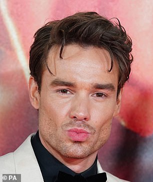 Liam Payne pictured in 2023. Plastic surgeons say they probably removed buccal fat or a fat pad on his cheek.