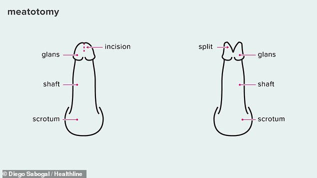 Penis splitting is done because someone simply likes the way it looks or because they want to increase sexual pleasure.  It is not known if the clinic does this.