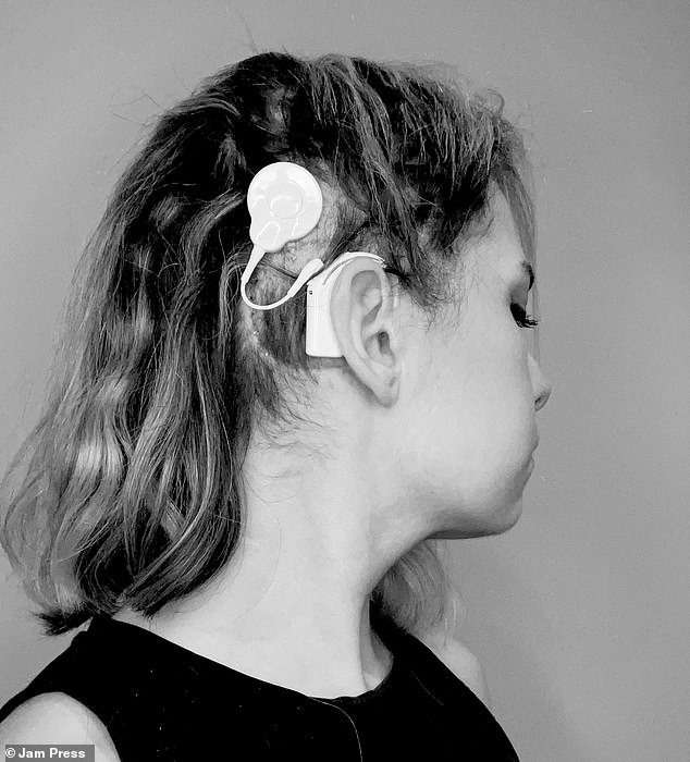 During surgery to remove the tumor in his ear, Scaglione had an auditory brainstem implant installed. Although she does not understand or hear language through the implant, she hears a humming sound that helps her point out specific things.