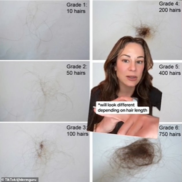 In this clip, Dr. Zubritsky presented a numbered chart showing a scale of hair loss and what it looks like in real terms.
