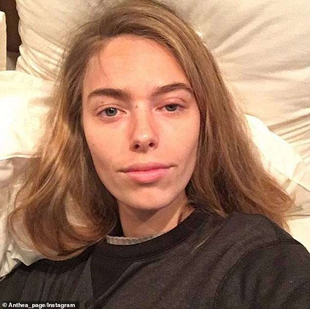Model Anthea Page contracted a staph infection after borrowing someone's makeup brush.