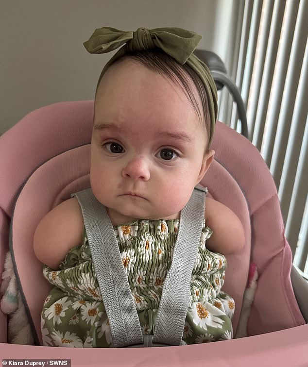 Doctors originally thought Arianna had Roberts syndrome, a genetic disorder characterized by facial and limb abnormalities, and thought she probably wouldn't make it to term.