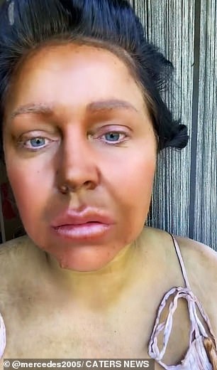Some followers advised her to use lemon juice to remove the fake tan.