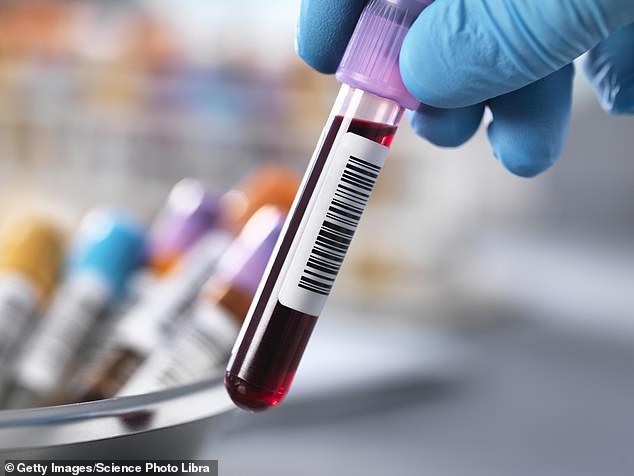 The test is a periodic blood draw that includes a report on the levels of different molecules, metabolites, proteins and chemicals in the blood, as well as an indication of the levels of inflammation in the body.