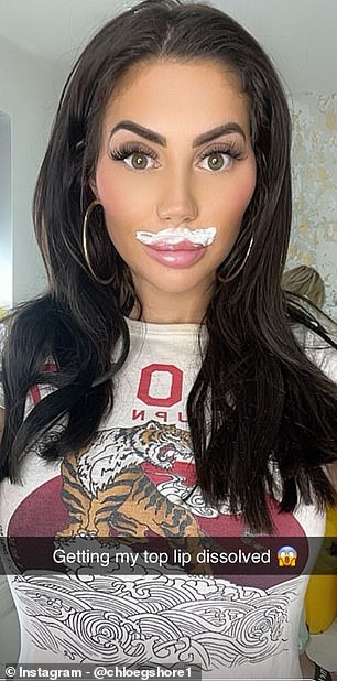 Chloe Ferry, 27, announced she will be dissolving her upper lip filler, just two weeks after undergoing breast reduction surgery in Turkey.