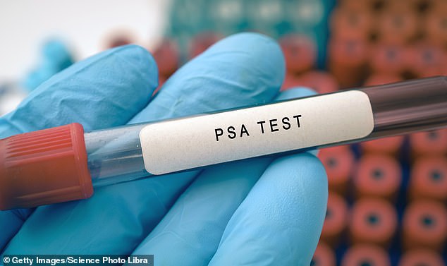 The study found that these PSA tests had little impact on reducing the number of deaths and, in some cases, did not detect some aggressive cancers early (file image)