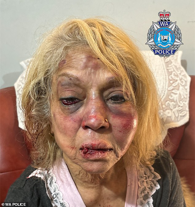 Officers released a gruesome image of the woman's injuries, with her permission, to illustrate the brutality of the attackers.