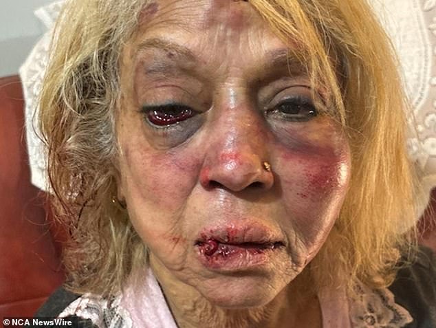 Ninette Simons (pictured) was allegedly attacked, and the group pinned her to the ground and punched her in the face several times, rendering her unconscious.