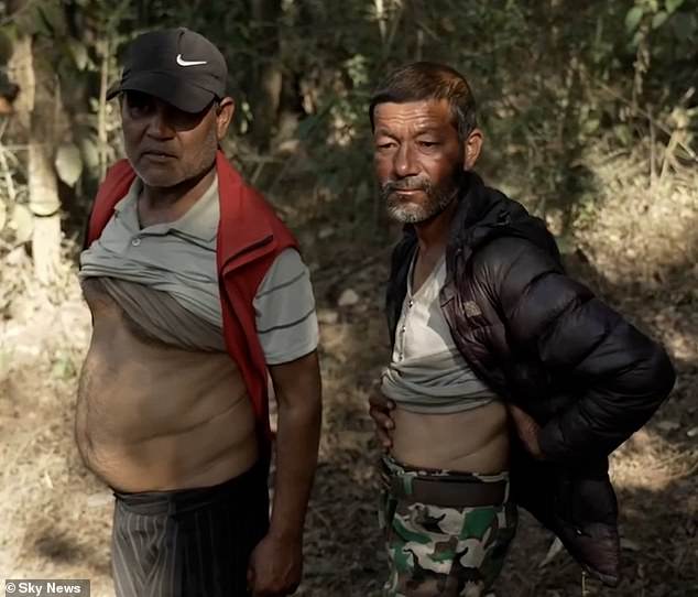 Two Nepalese men reveal their scars after selling their kidneys.  They told Sky News they were motivated by financial need.