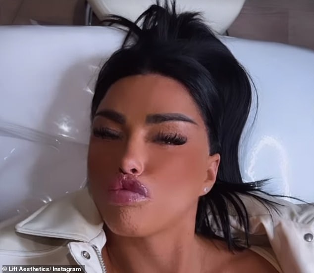Katie showed off her third round of lip fillers in just four weeks as she puckered her pout in an Instagram video last month.