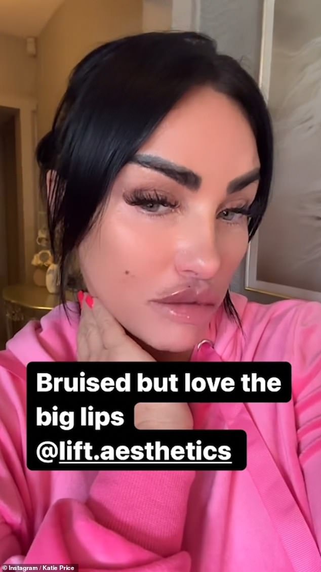 Katie Price has revealed the results of another round of lip fillers, after visiting the beauty salon for the fourth time in five weeks.