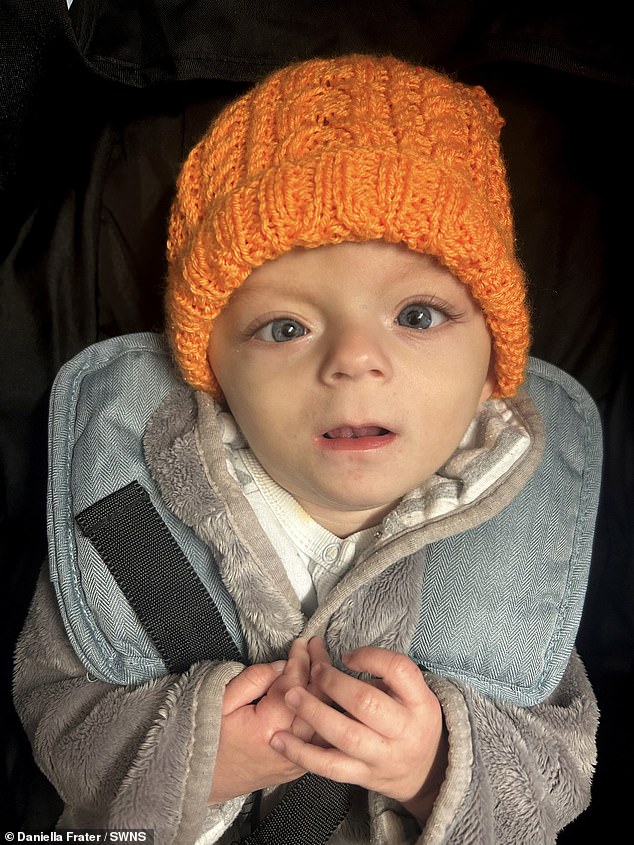 Miracle baby born without part of his brain has survived
