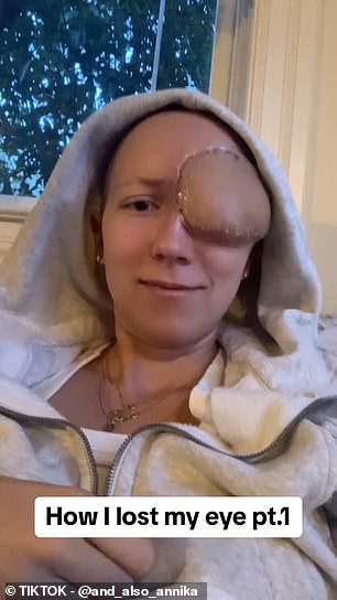 Annika, 28, was diagnosed with a rare nasal cancer after doctors mistook it for a sinus infection.