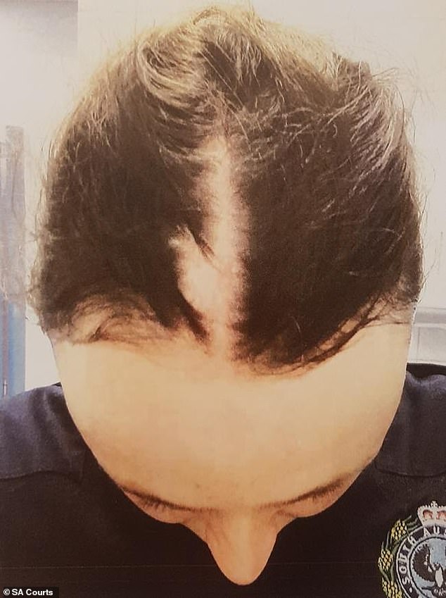 The court heard Cruise launched a violent attack on Constable Anthea Beck outside the Exeter Hotel in central Adelaide on the night of October 17, 2021, leaving the officer with a large section of hair torn from her scalp (in the photo).