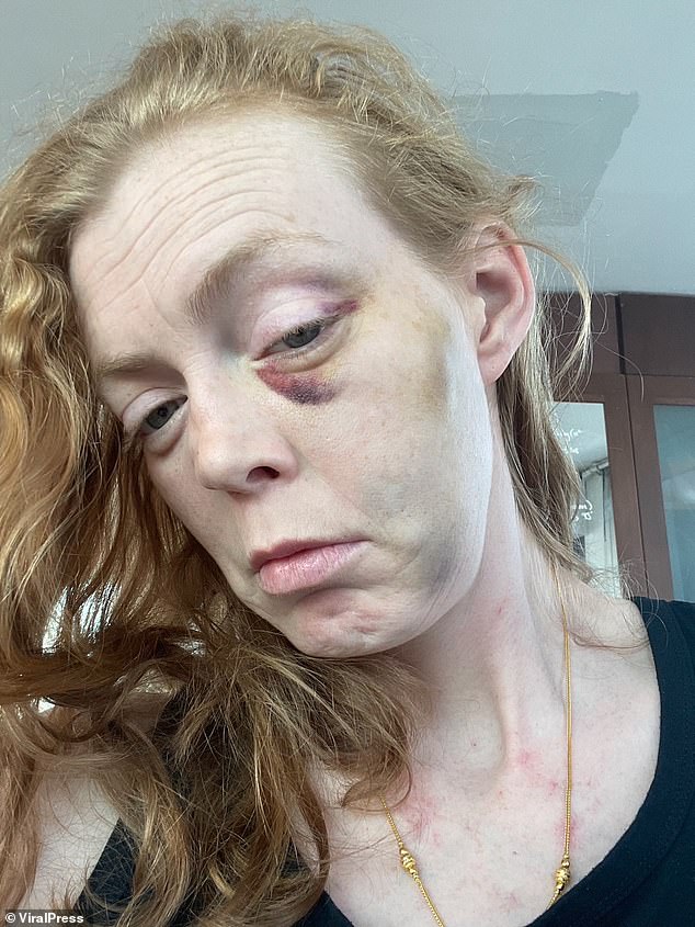 Ayesha Jane Cox, 37-year-old married mother, shows her injuries after attack in 2021