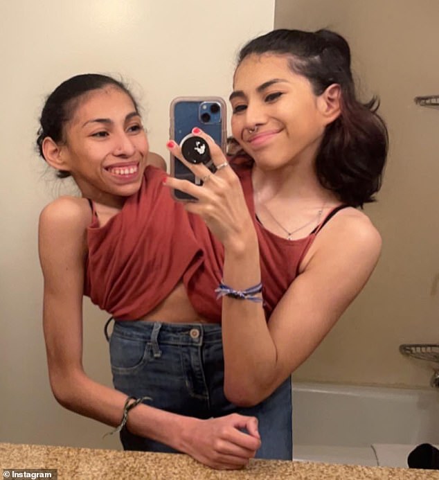 Conjoined twins Carmen (right) and Lupita Andrade, 23, are as close as two sisters can be, and now they're sharing their honest answers to frequently asked questions about their lives.