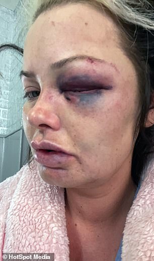 Jodie's attacker, John Paul Wilkinson, brandished a machete during the attack.  He had been a serial abuser throughout their relationship.