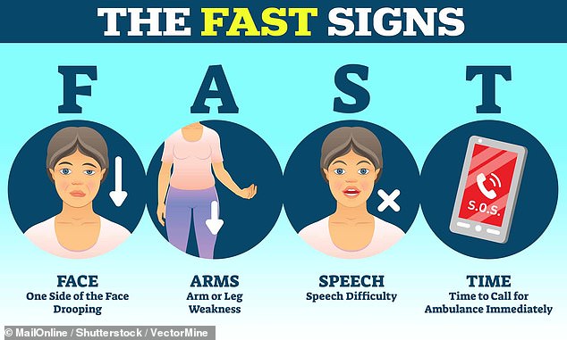 Stroke symptoms are commonly remembered by this four-letter acronym, FAST.  Patients who suffer a stroke may often have their face drooping to one side, have difficulty raising both arms and difficulty speaking, while time is of the essence as immediate treatment for a transient ischemic attack (TIA) or A minor stroke can substantially reduce the risk of having a stroke.  much deadlier stroke