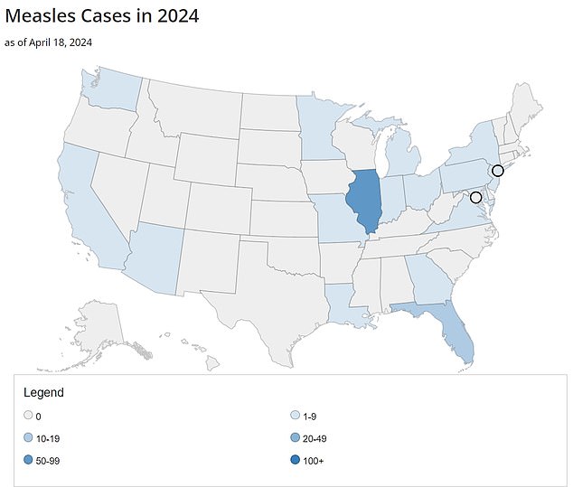 Chicago is at the epicenter of the measles outbreak in the US, with 58 cases recorded so far