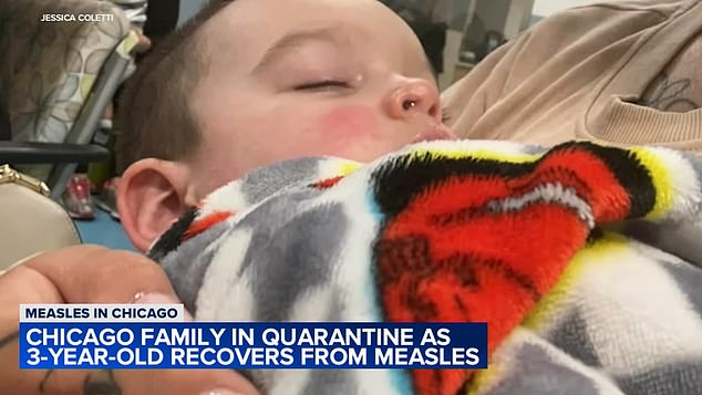 He also battled a fever for five days, his mother said, before recovering.  She is now worried about her 10-month-old daughter Vanna.