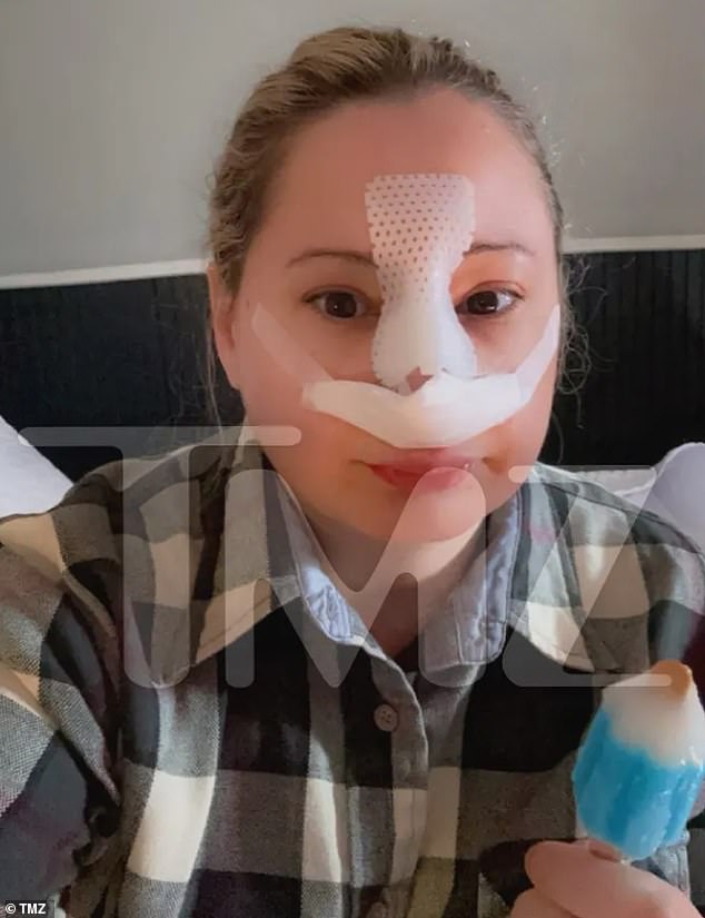 The 32-year-old released felon gave a photo of her post-op nose to TMZ, taking a selfie all bandaged up and eating a popsicle.