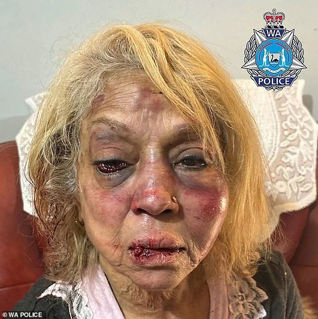 Ninette Simmons, 73, and her husband Phillip, 76, were left bruised and shaken after three men allegedly assaulted them and stole jewelery from their Perth home on April 16.