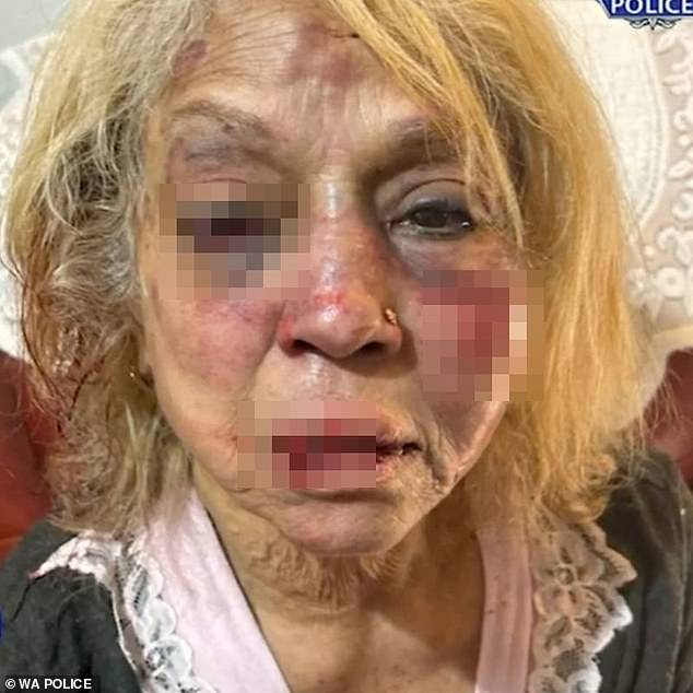 Horrible injuries suffered by Ninette Simons (pictured) allegedly inflicted by a released detainee