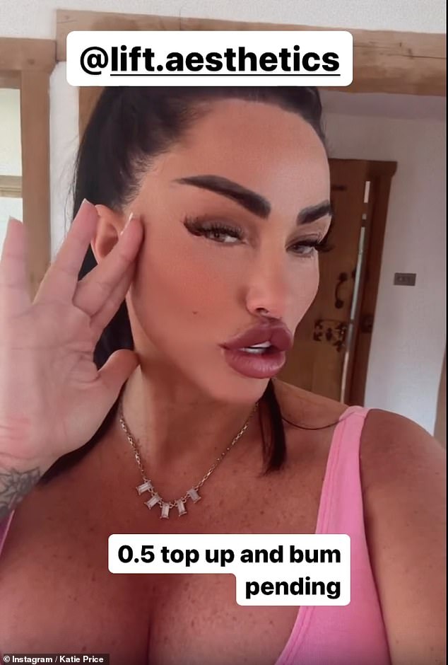 The former Glamor model, 45, took to Instagram after the procedure to flaunt her pout on her Stories.