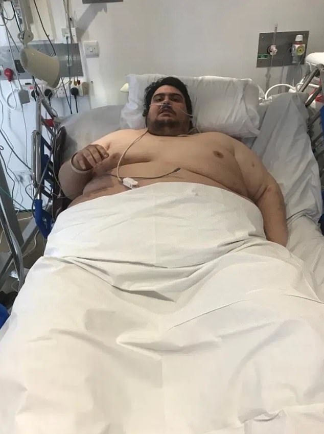 Jason Holton, from Camberley, Surrey, (pictured) weighed 47kg and was suffering from organ failure.