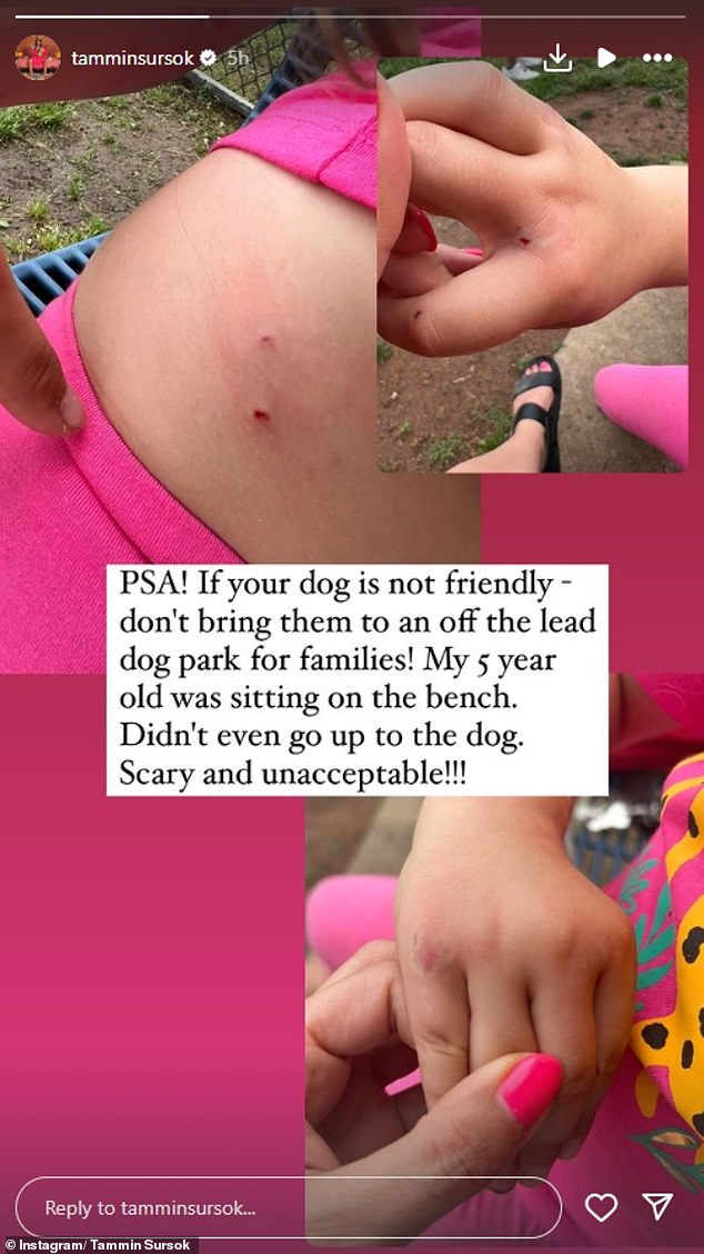 The Pretty Little Liars actress, who now lives in Nashville, took to Instagram on Sunday to share the horrific injuries her five-year-old daughter Lennon suffered when she was brutally attacked by a dog.