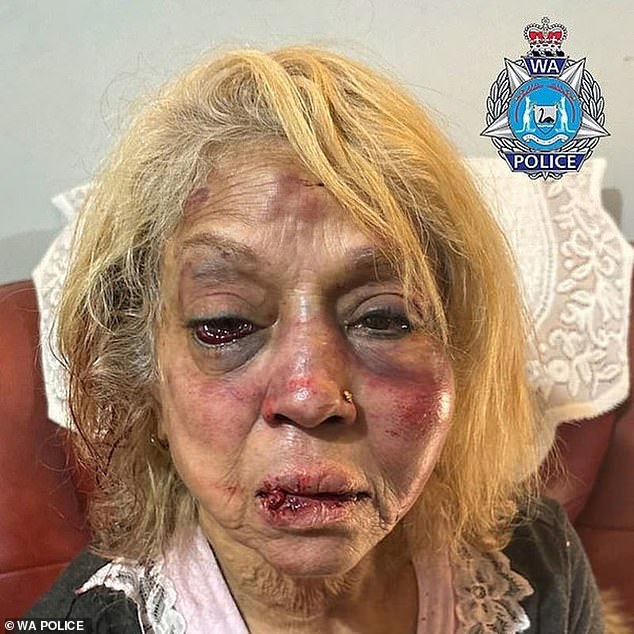 Another released detainee, Majid Jamshidi Doukoshkan, 43, is one of three people charged in the alleged brutal attack on Ninette Simmons, 73 (pictured).