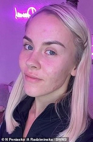 Dancer and acrobat Nina Peniasko shows off her imperfections in a snap shared alongside a photo of her rocking a more glamorous look with coral lipstick and a radiant smile.