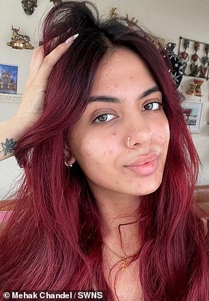 Mehak Chandel, 23, a special needs teaching assistant from Southall, London, showed the real texture of her slightly mottled skin.