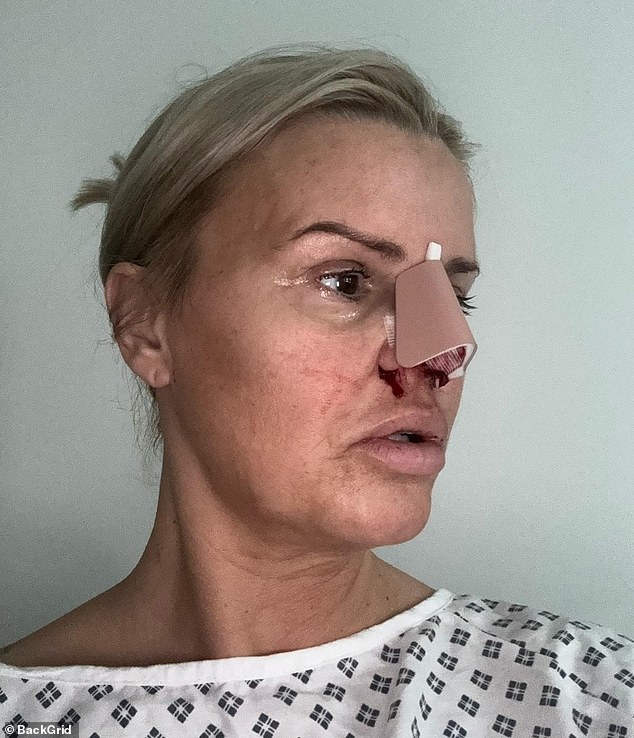 The former Atomic Kitten star, 43, had surgery at Pall Mall Cosmetics after she was left with a hole in her septum after taking drugs in her twenties.