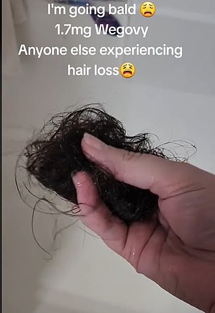 And in the photo above, this woman posted a disturbing TikTok holding a strand of hair that fell out in the shower.