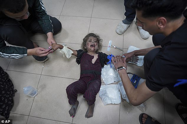 Palestinian doctors treat a baby injured in the Israeli bombardment of the Gaza Strip at the Al Aqsa hospital in Deir al Balah.