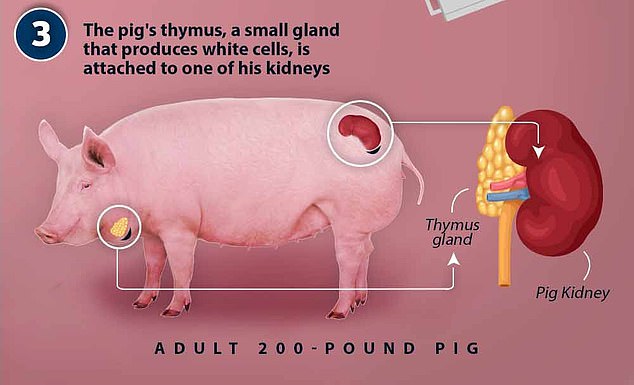 1715478907 443 Patient 62 who had worlds first successful pig kidney transplant