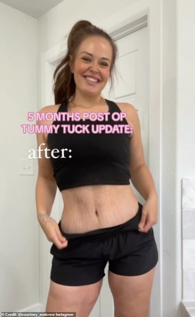 Last July, Mrs. Kleinebreil, who has three children, took the plunge and underwent a cosmetic procedure to tighten her stomach muscles. Earlier this year, she underwent a breast lift with fat transfer to fix her 'deflated' triple D breasts, and she detailed her journey on social media.