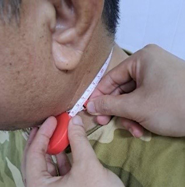 Doctors also measured the patient's neck to diagnose the condition, which is caused when the airway becomes blocked while someone sleeps, leaving them with difficulty breathing.