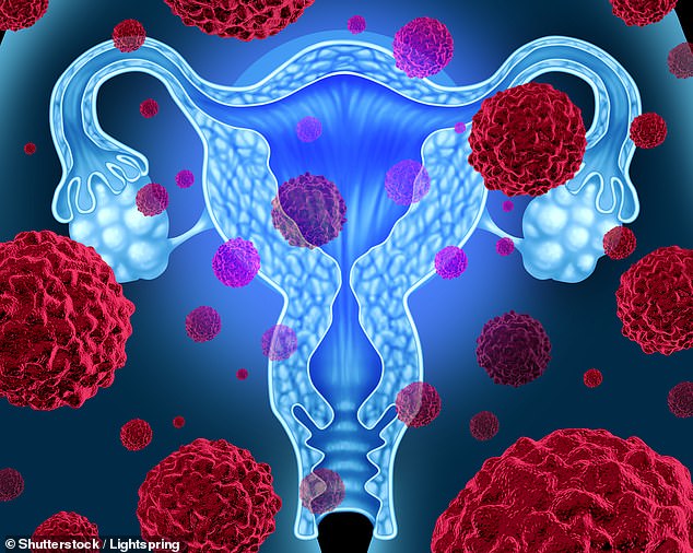 Human papillomavirus is an STD that can cause cells in the vagina to mutate. In some cases, this leads to the development of cervical cancer. Doctors say it's essential to get tested, through a Pap smear, regularly.