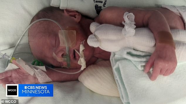 Their son, Greyson, (pictured) was born on March 12, weighing just over two pounds after an unexpected C-section.  After a harrowing 51-day stay in the neonatal intensive care unit, Greyson was finally medically cleared to leave the hospital.