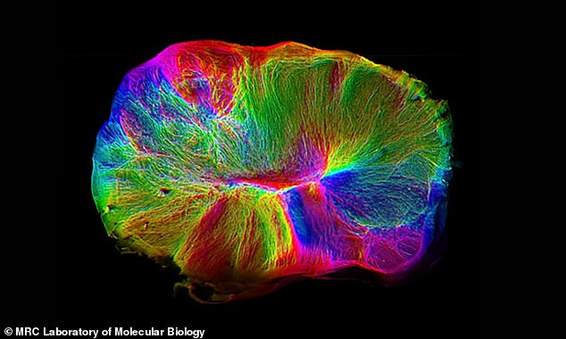 The tiny organoid, about the size of a lentil, was created from connected human brain cells for a 2019 study.